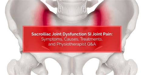 Sacroiliac Joint Dysfunction: Diagnosis and Treatment 